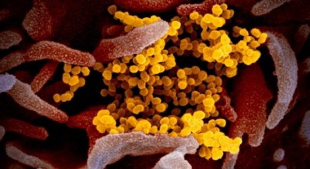 Coronavirus